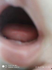 快长牙图片,宝宝快长牙的可爱瞬间回顾